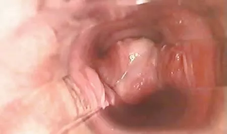 Husband fucks fist pussy wife while she caresses vibrator clitoris